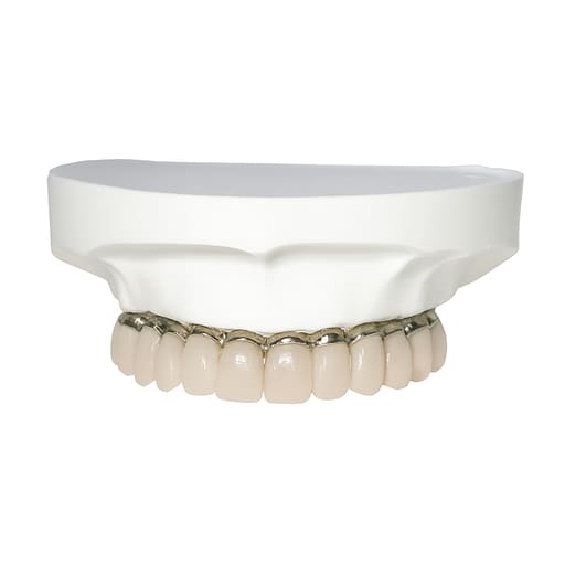 iDENTical All-On-4 Overdenture Model M6023
