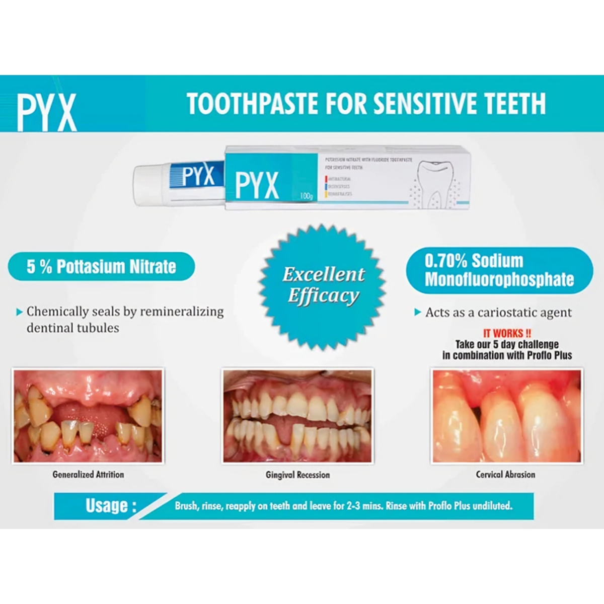 Sandika Pharma Pyx Toothpaste For Sensitive Teeth - 50g (Pack of 12) (Short Expiry 07-2026)