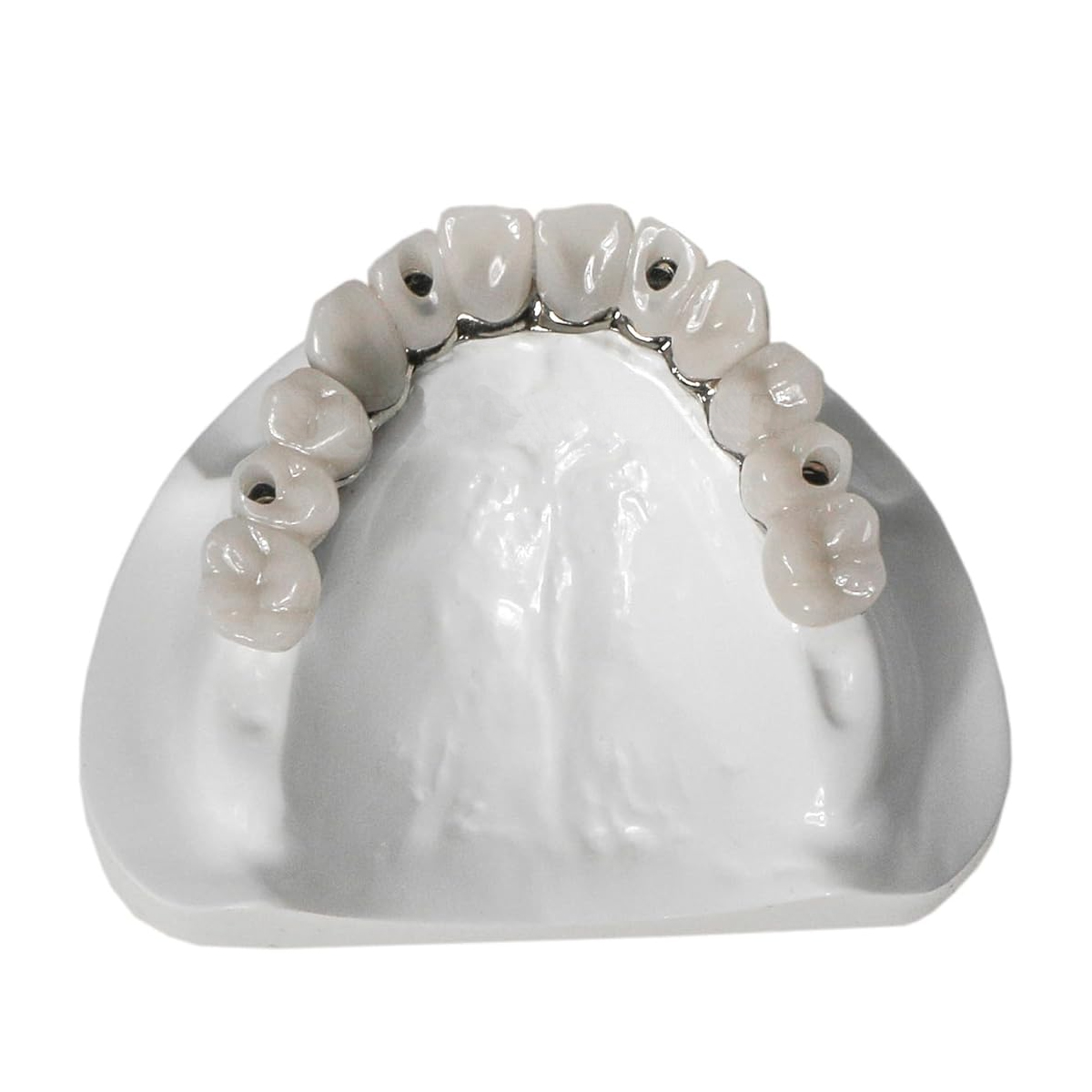 iDENTical All-On-4 Overdenture Model M6023