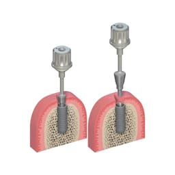 Dental