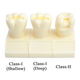 iDENTical Cavity Demonstration Model For Pre - Clinical Training 4X Size - Set of 12 M7025 - 3