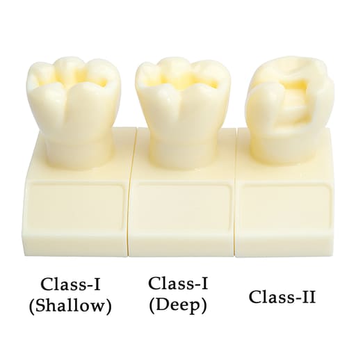 iDENTical Cavity Demonstration Model For Pre - Clinical Training 4X Size - Set of 12 M7025