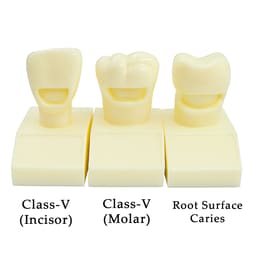 iDENTical Cavity Demonstration Model For Pre - Clinical Training 4X Size - Set of 12 M7025 - 5