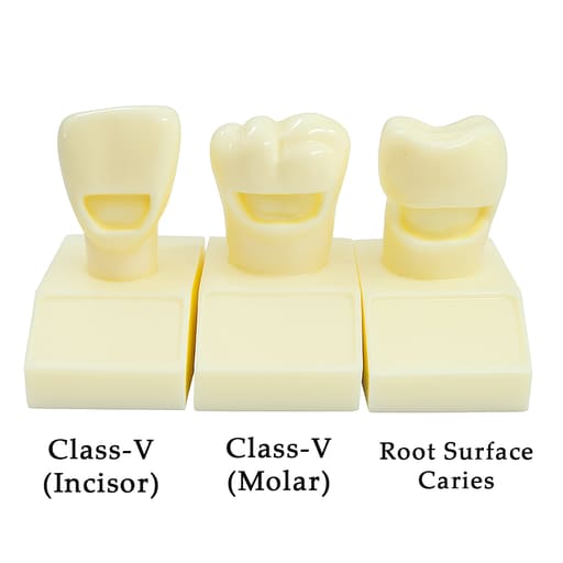 iDENTical Cavity Demonstration Model For Pre - Clinical Training 4X Size - Set of 12 M7025
