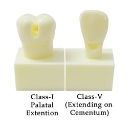 iDENTical Cavity Demonstration Model For Pre - Clinical Training 4X Size - Set of 12 M7025 - 6