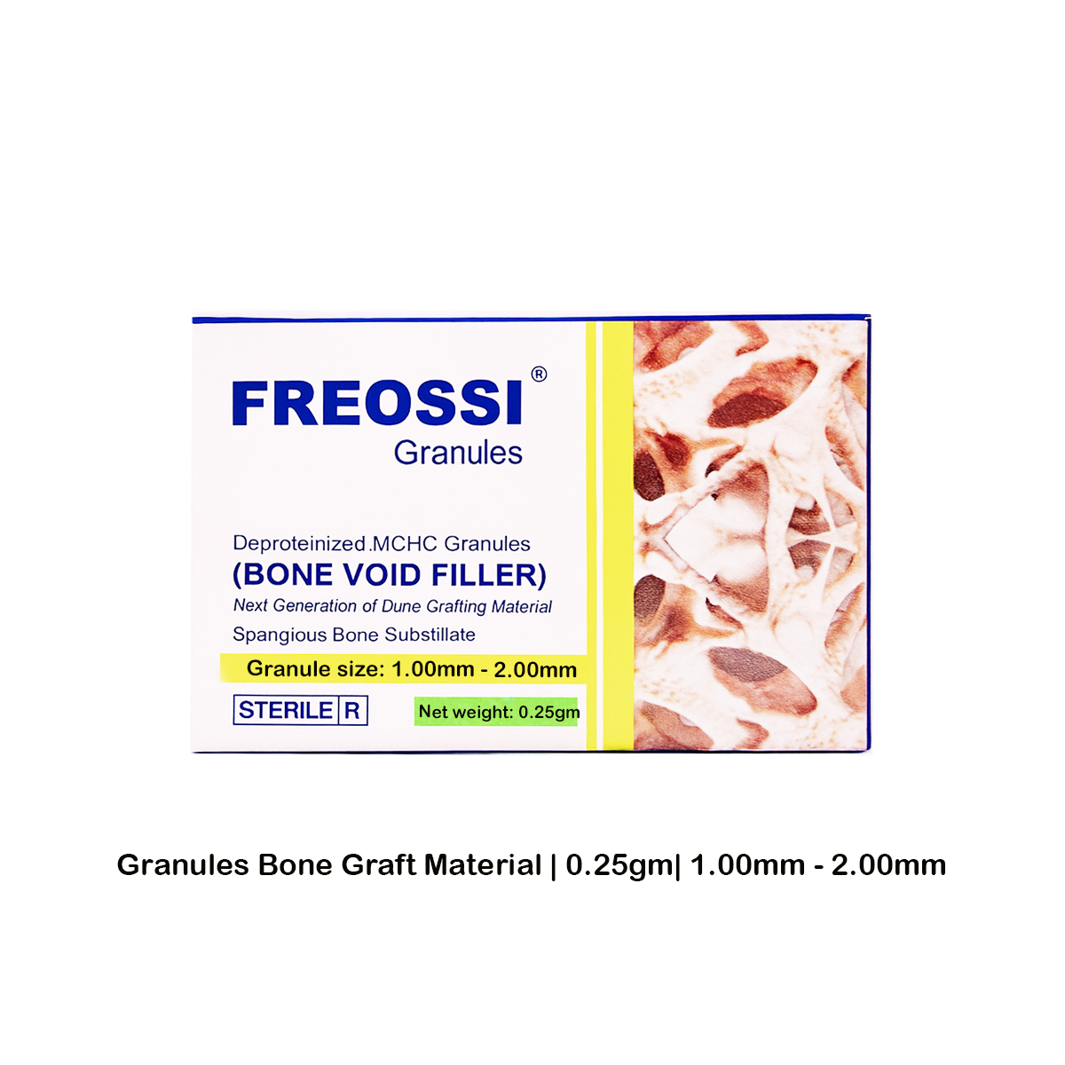 Fredna