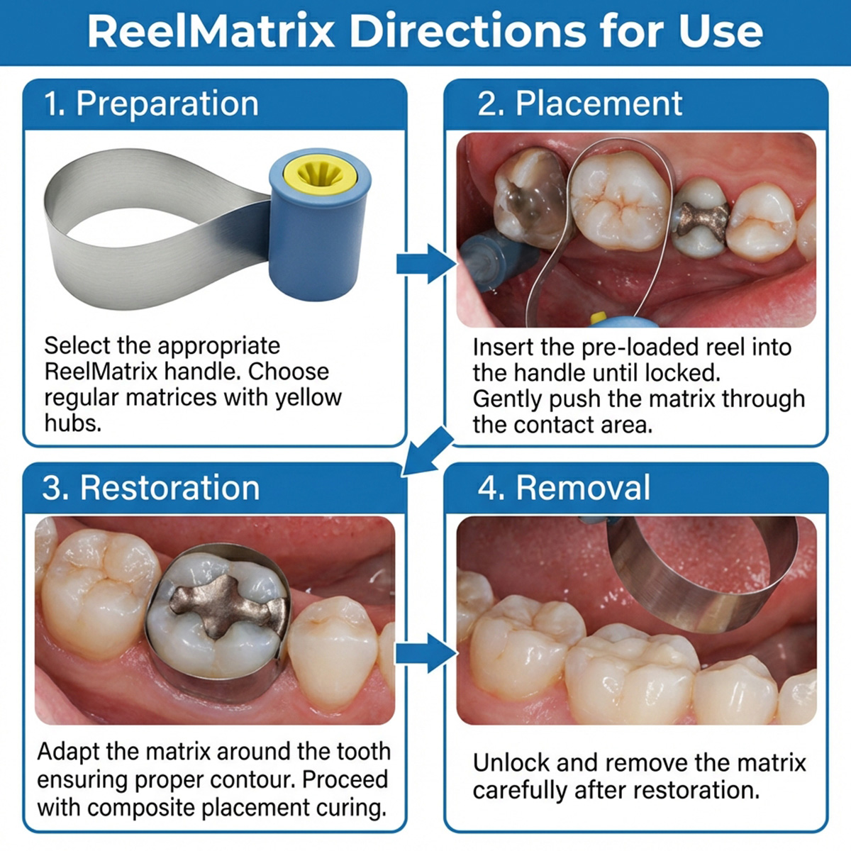 Garrison Dental ReelMatrix Regular Matrices (5mm) - Pack of 50