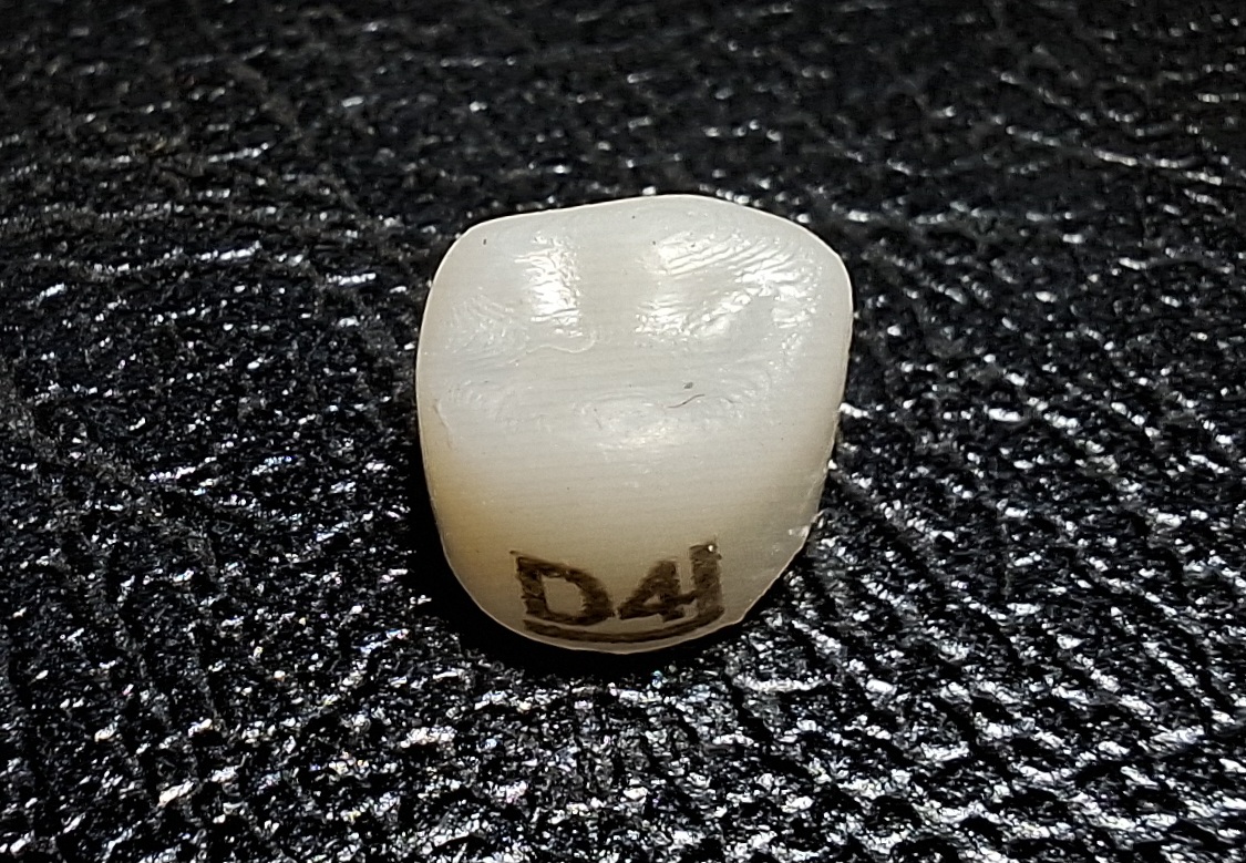 Pedo Crown Primary 1st Upper Molar Refills