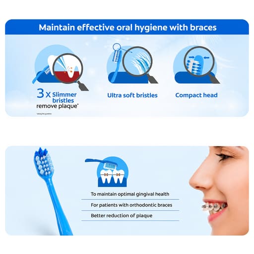 MyOra C-Soft Orthodontic Toothbrush (Pack Of 12)