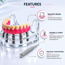 Julldent Overdenture Implant Model with 6 Implants (JULL-DENT 202) - 4