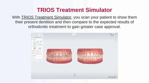 3Shape Trios 3 Color Pod Intraoral Scanner