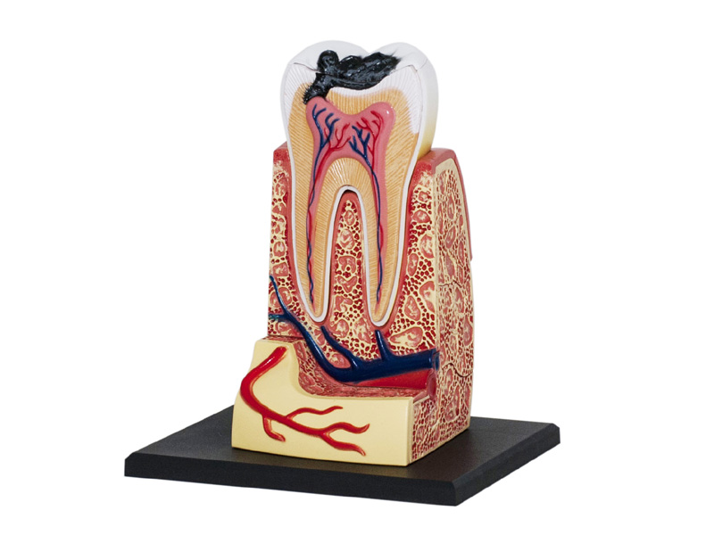 iDENTical Anatomical 3D Molar Model Colored M7036