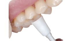 Youdent Silicone Polishers For Composite White (Pack Of 25) - 9