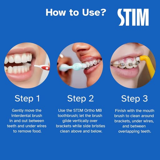 Stim Ortho Mb Brush (Pack Of 12)