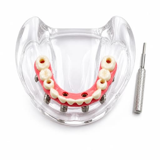 Julldent Overdenture Implant Model with 6 Implants (JULL-DENT 202)