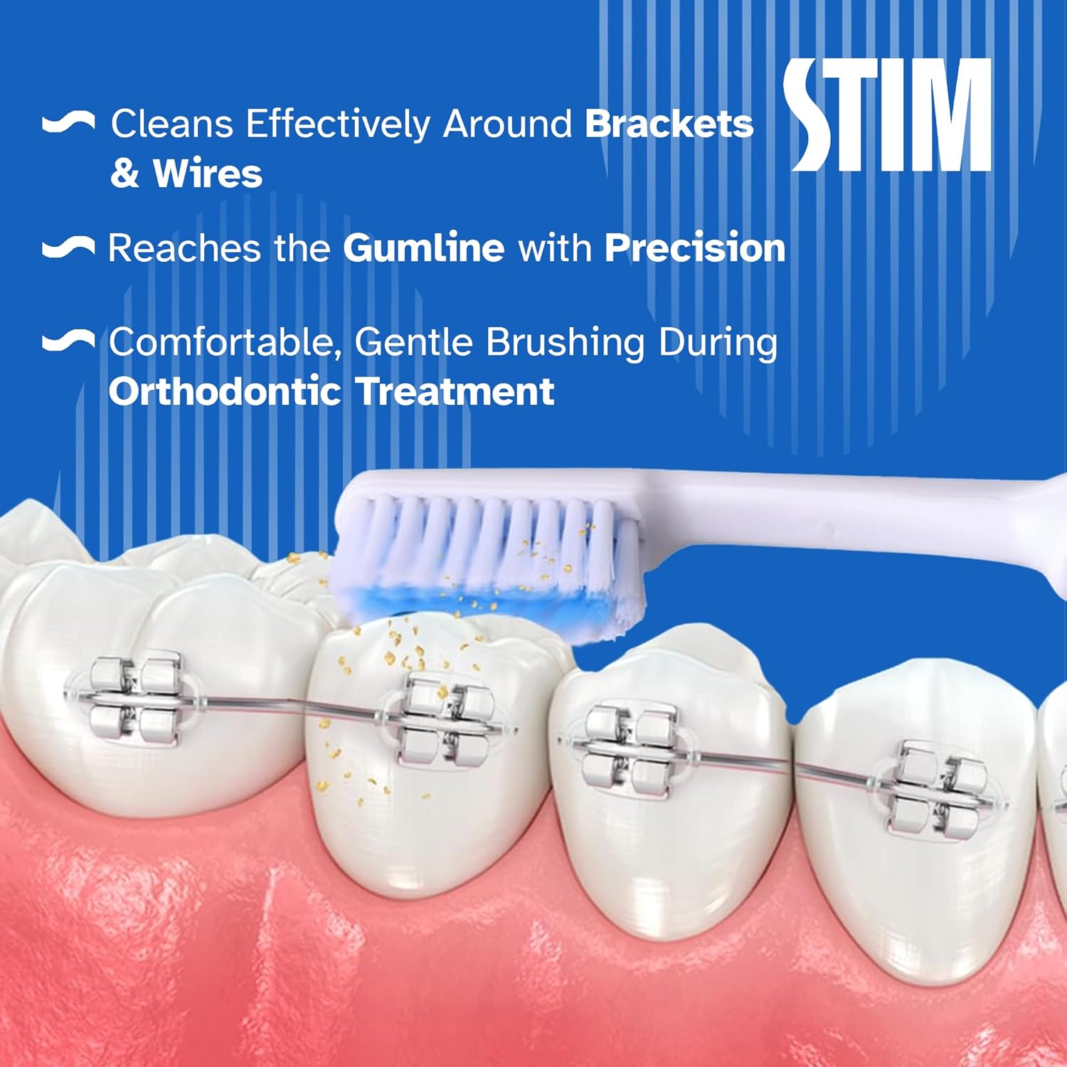 Stim Ortho Mb Brush (Pack Of 12)