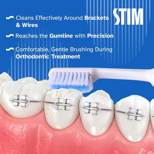 Stim Ortho Mb Brush (Pack Of 12)