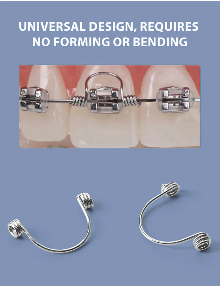 UU Ortho Torque Springs 10 Pcs/Bag