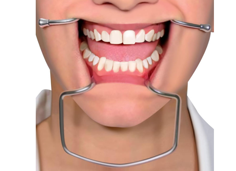 Waldent Oringer Lip & Cheek Retractor Medium - 14.5cm (8/120)