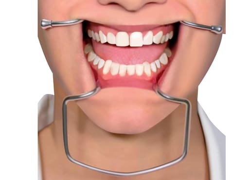 Waldent Oringer Lip & Cheek Retractor Medium - 14.5cm (8/120)