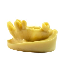 iDENTical Implant Practice Model With Extraction Sockets M2045 - 3