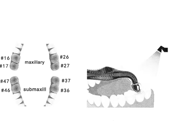 Dental