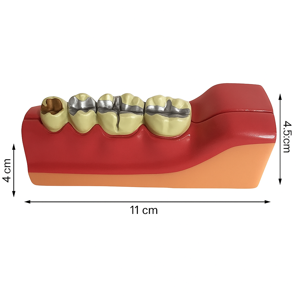 iDENTical Third molar Impaction Teeth Model M4009