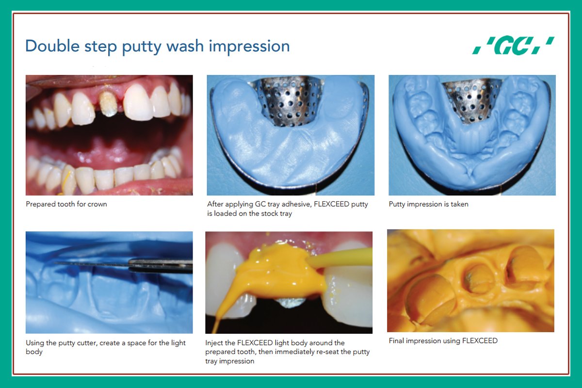 GC Flexceed Putty And Kit