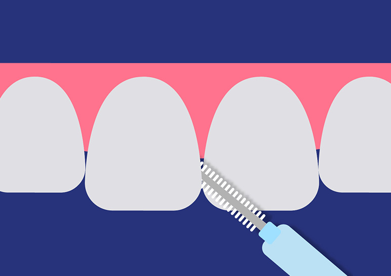 MyOra FlexiClean I-Shape Interdental Brush 0.6mm Green - Pack Of 1