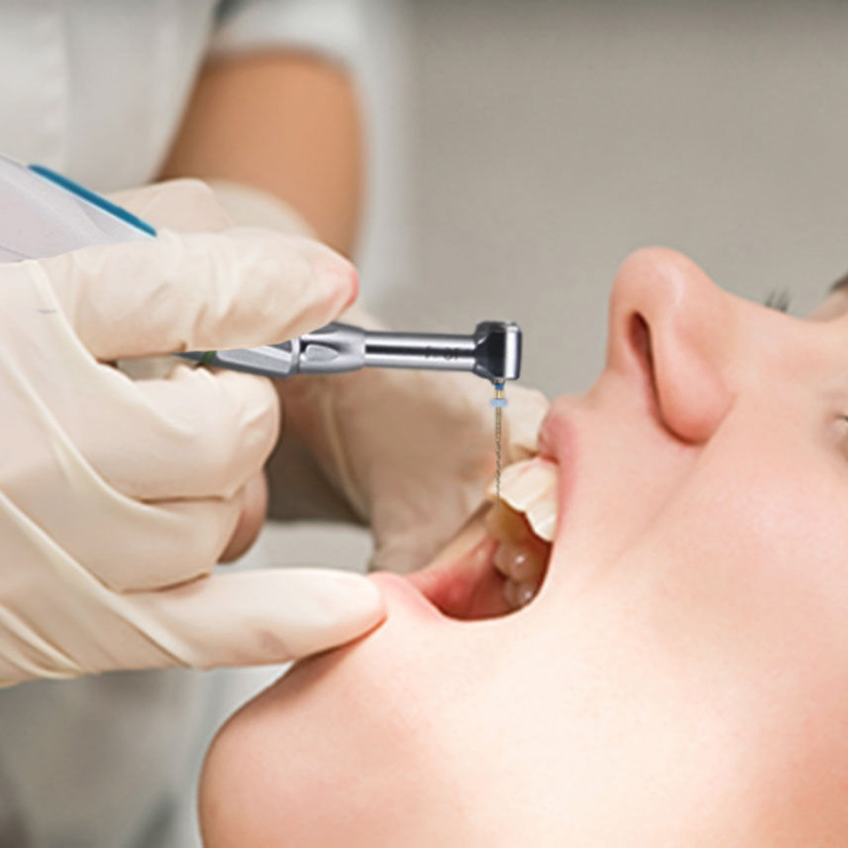 MIK CurvXPro NiTi Rotary Files - 21mm (Pack of 6)