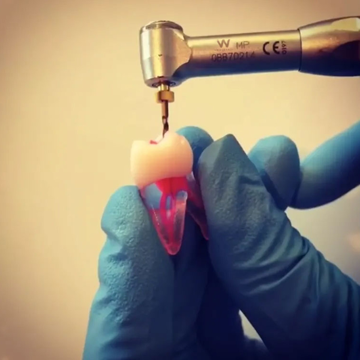 MIK CurvXPro NiTi Rotary Files - 21mm (Pack of 6)