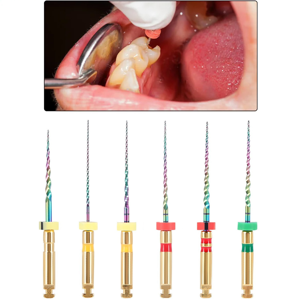 MIK CurvXGlide NiTi Rotary Files 21mm (Pack of 6)