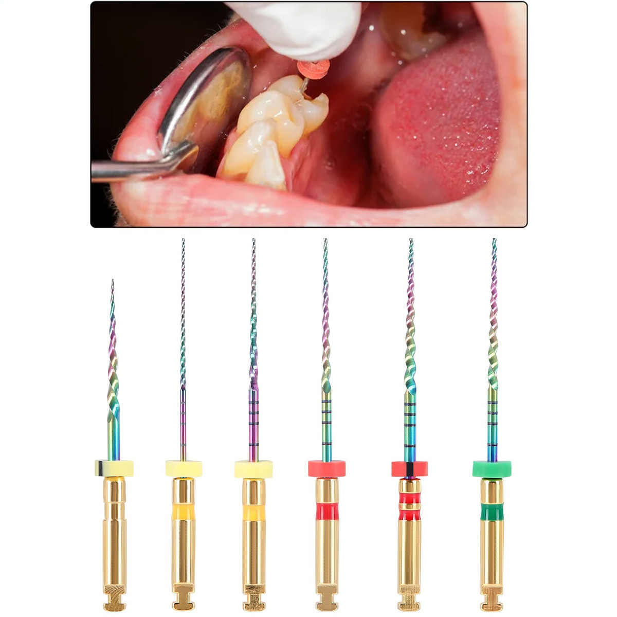 MIK CurvXGlide NiTi Rotary Files 25mm (Pack of 6)