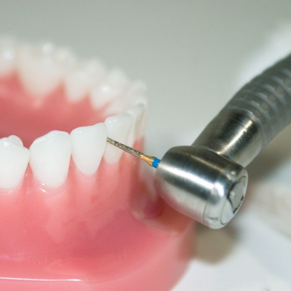 Prima Dental Needle Bur FG (Pack Of 5 Burs) 859 (016)