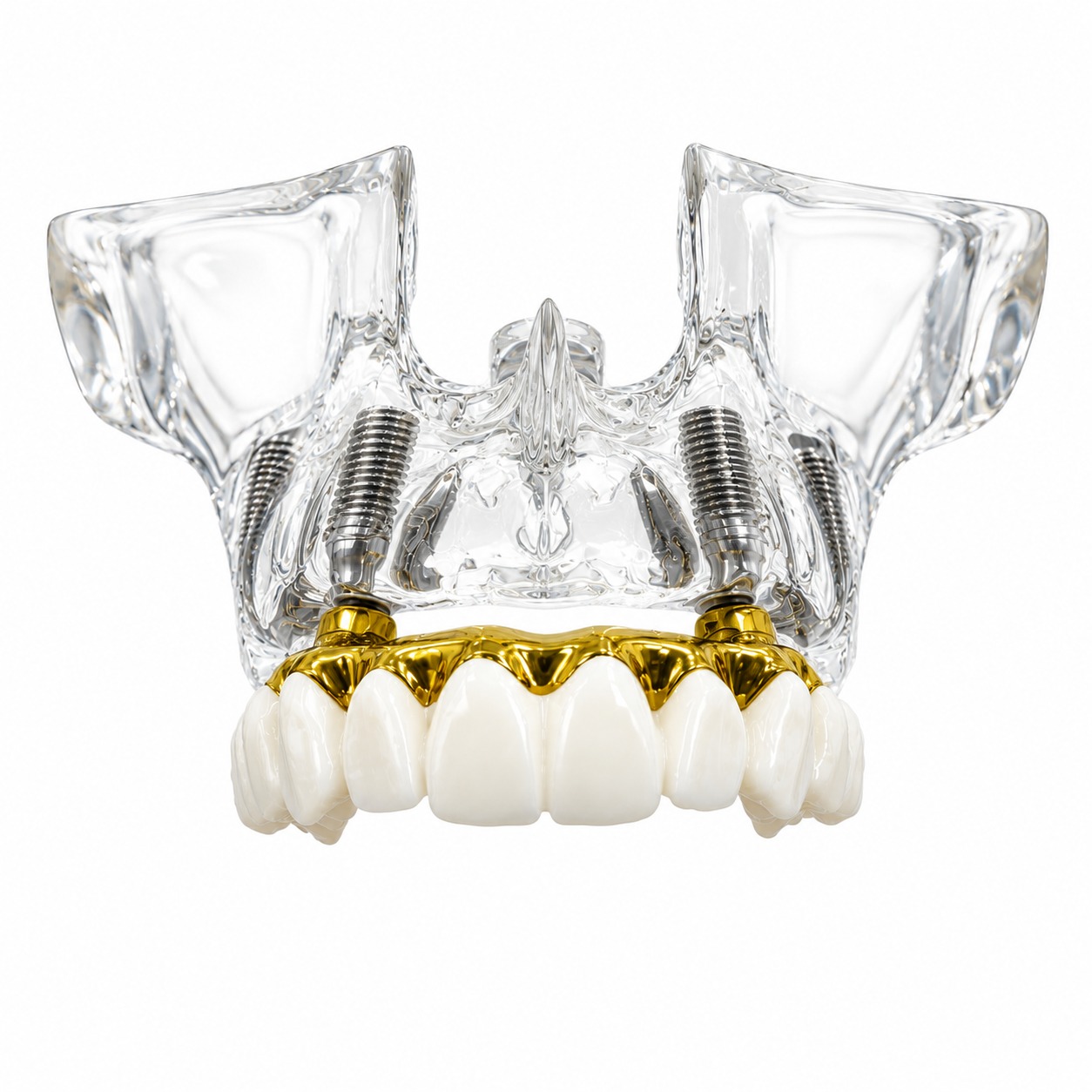 Buy Julldent Upper Jaw Implant Model (JULL-DENT 205) at Best Price on ...