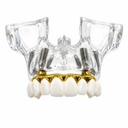 Julldent Upper Jaw Implant Model (JULL-DENT 205) - 1