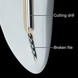 Waldent Cutting Drills For EndoResQ File Retrieval System (Pack Of 3) - 3