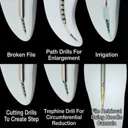 Waldent Needle Cannula For EndoResQ File Retrieval System (Pack Of 3) - 8
