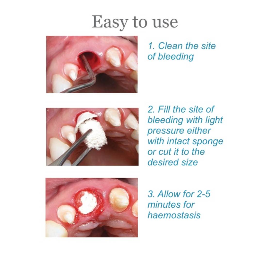 Goodwill Hemosponge 10x10x10 MM Absorbable Gelatin Sponge 32/pk - GL111