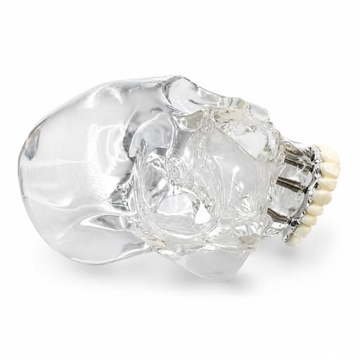 Julldent Skull Implant Model (JULL-DENT 209)