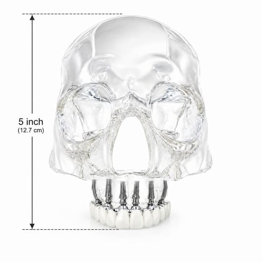 Julldent Skull Implant Model (JULL-DENT 209)