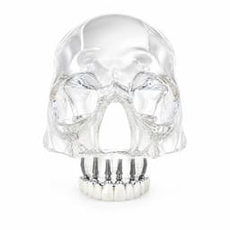 Julldent Skull Implant Model (JULL-DENT 209) - 6