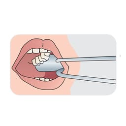 Julldent Bishop Third Molar Retractor (JULL-DENT 226) - 3