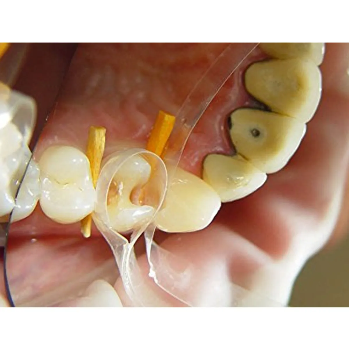 Oro Wooden Wedges - Yellow