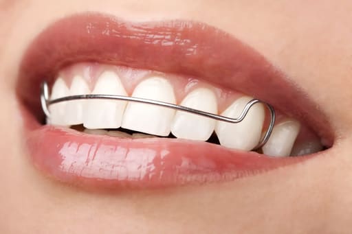 Smith Stainless Steel Dental Wires 