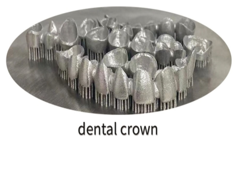 Labodent Nickel Chromium Alloy Powder (10-30μm) - 5Kg