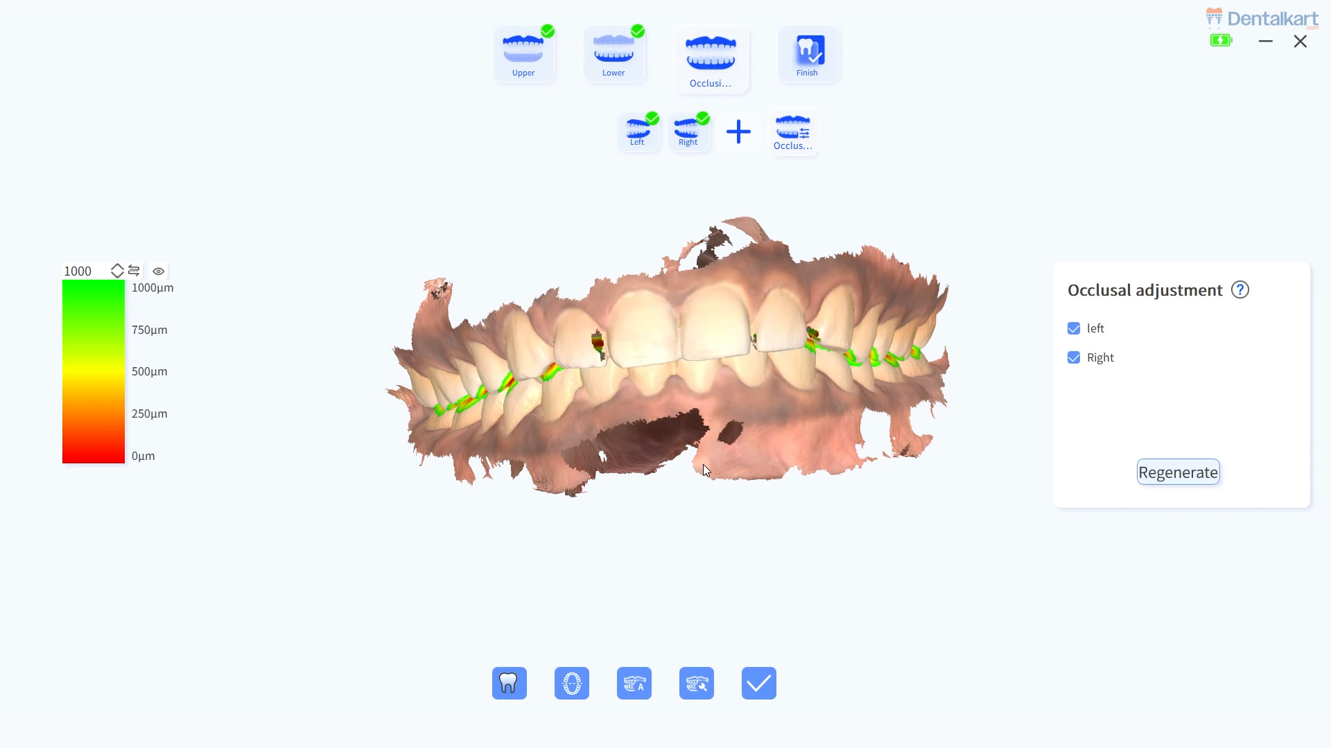 Waldent BLZ IntraVue 900 Ai Intraoral Scanner | Call +91-9311803455 For Easy Finance Options