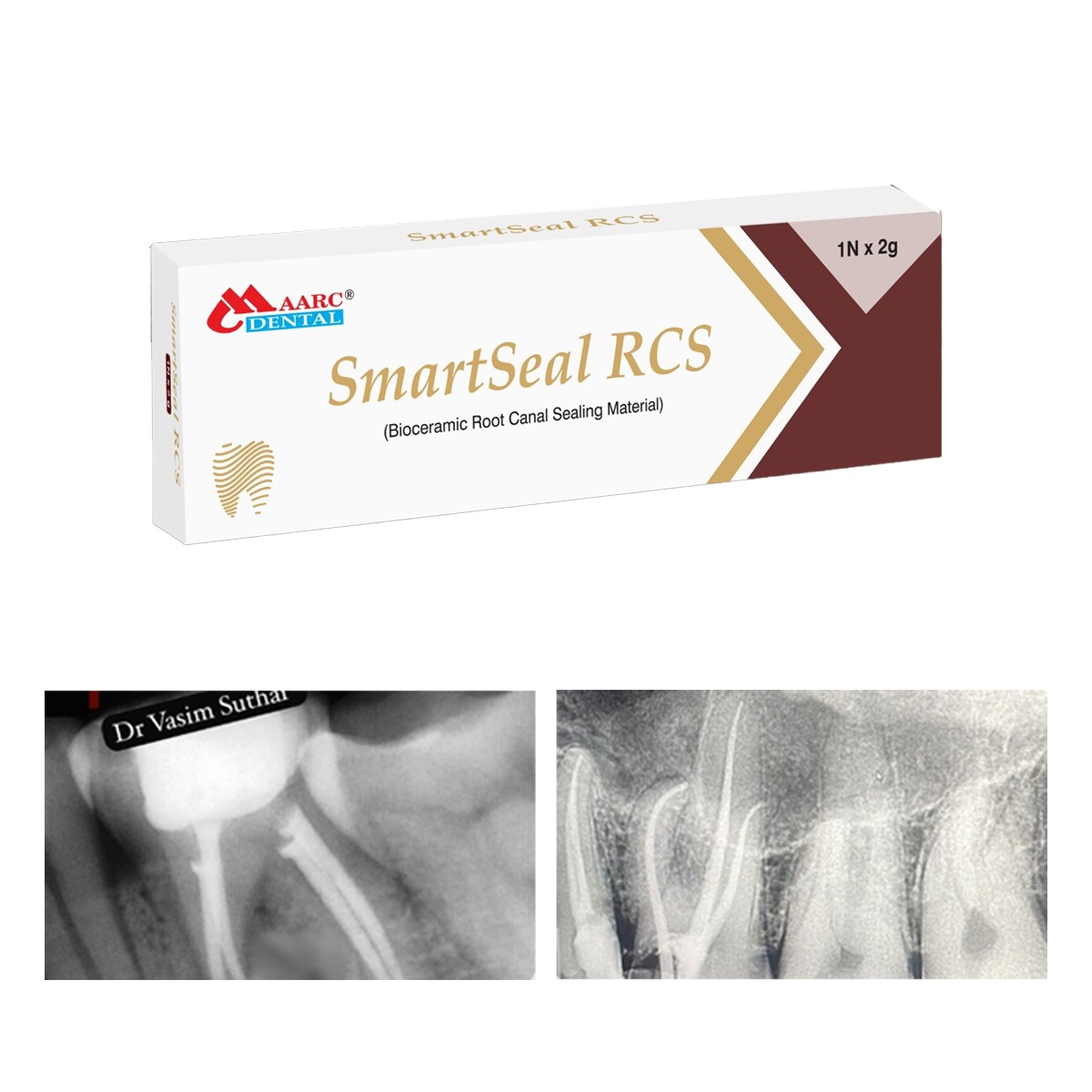 Maarc SmartSeal RCS Bioceramic Root Canal Sealing Material  (9985/002)