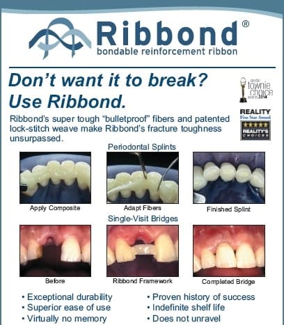Ribbond Ribbon Fiber Splint