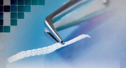 Ribbond Ribbon Fiber Splint - 7